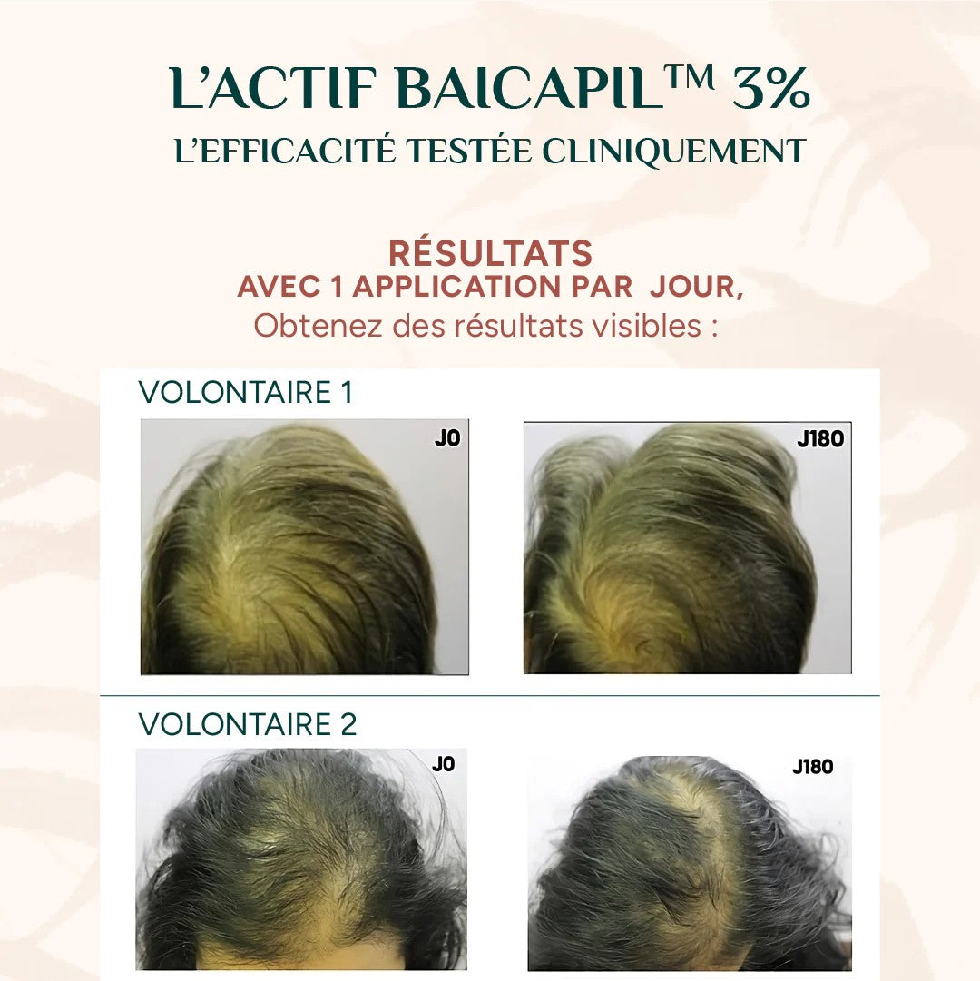 Sérum croissance capillaire Nayana